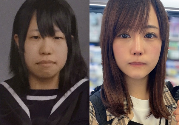 みきしぃさんのビフォーアフター(画像:本人提供)