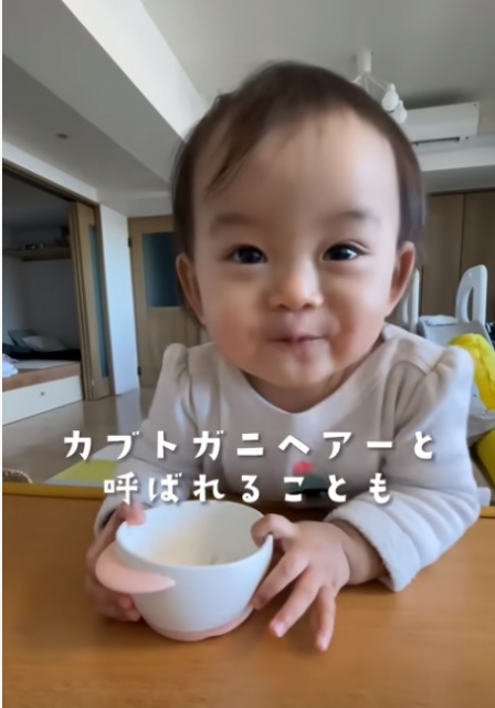 薄毛の赤ちゃんが少女の髪になるまでの成長動画に860万再生 生まれつき薄毛で悩んでいた オリコンニュース 岩手日報 Iwate Nippo
